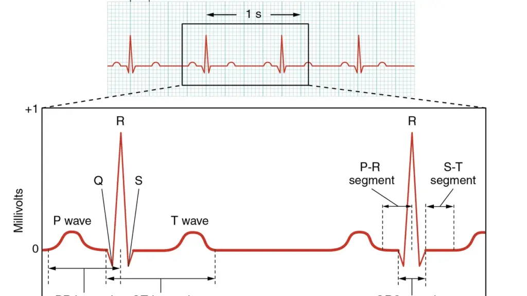 Close-up view of an electrocardiogram paper readout displaying cardiac rhythm waves and physiological voltage spikes.