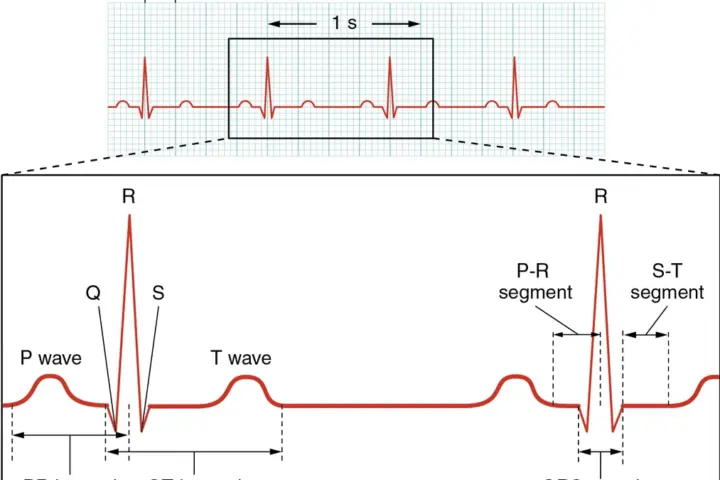 Close-up view of an electrocardiogram paper readout displaying cardiac rhythm waves and physiological voltage spikes.